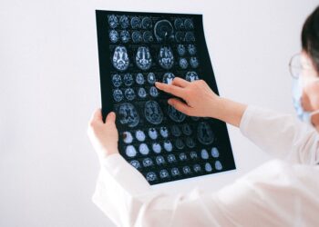 Bir doktor elinde tuttuğu beyin MR'ı filmindeki görüntüleri inceleyerek gösteriyor.