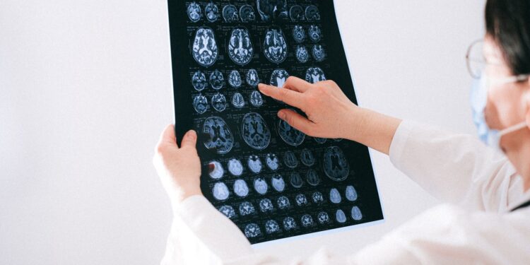 Bir doktor elinde tuttuğu beyin MR'ı filmindeki görüntüleri inceleyerek gösteriyor.